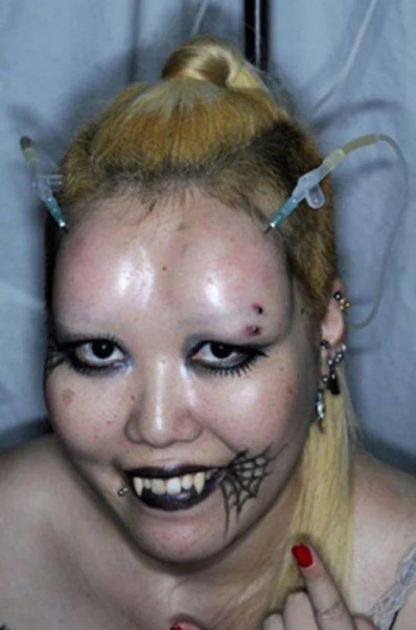 Bagel Heads — Blonde woman with two saline injection needles inserted into her forehead.