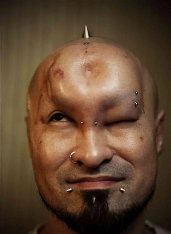 Bagel Heads — Bald pierced man with one massively swollen eye area from saline injection.