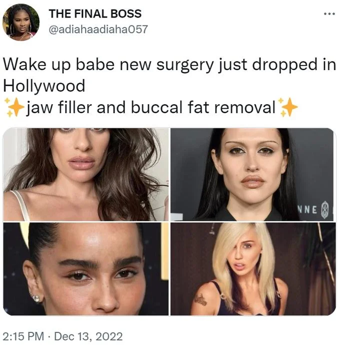 Buccal Fat Removal — Twitter screenshot from @adiahaadiaha057 captioned 'Wake up babe new surgery just dropped in Hollywood' with collage of celebrity women