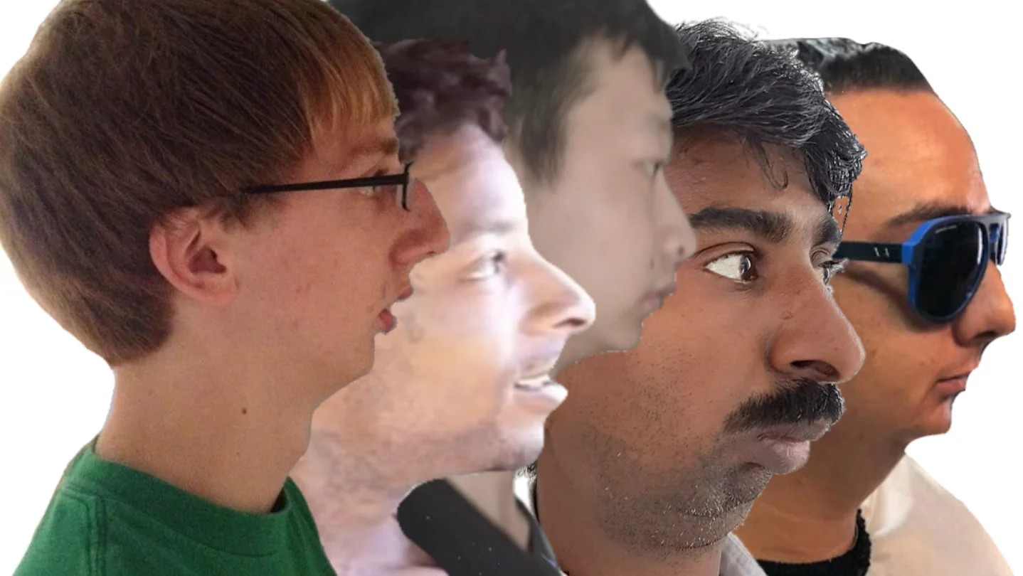 Chinlet — Collage of five men in side profile all showing weak, receded chins