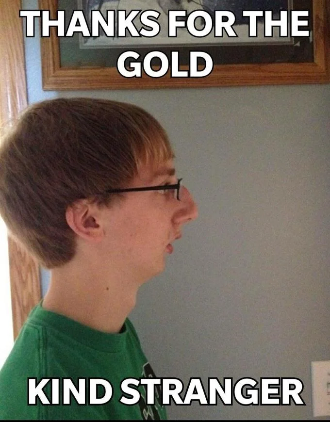 Chinlet — Meme of a young man in profile with weak chin, captioned Thanks for the gold kind stranger