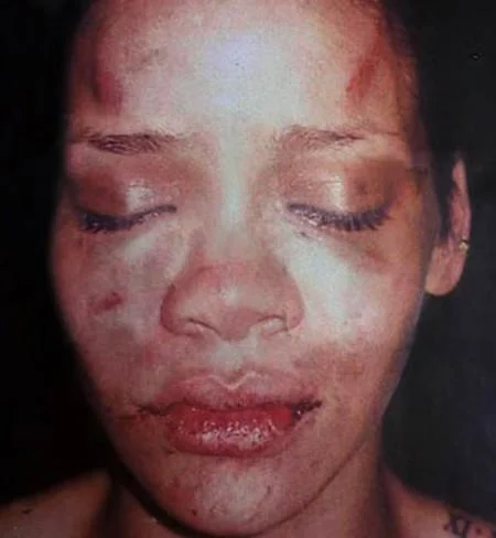 Photo of Rihanna's bruised face after the 2009 assault