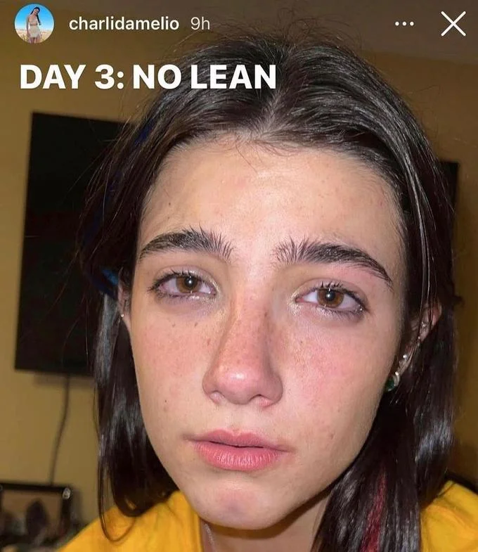 Day 1, 2, 3 No Lean — Charli D'Amelio Instagram story with tired face captioned 'DAY 3: NO LEAN'