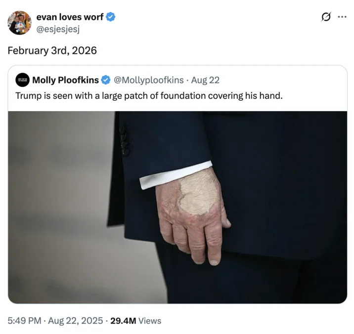 Donald Trumps Hand Makeup And Death Speculation — February 2026 Twitter post reposting the Trump hand makeup photo from the original August 2025 viral moment.
