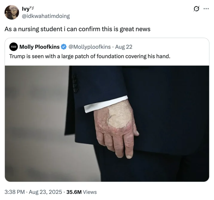 Donald Trumps Hand Makeup And Death Speculation — Twitter reply with hand photo and commentary from someone claiming nursing expertise about the appearance.