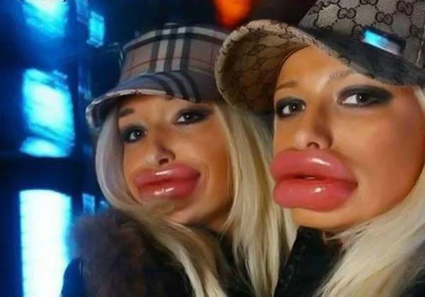 Duck Face — Two women with extremely enlarged lips posing in designer bucket hats