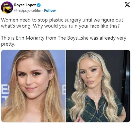 Erin Moriarty Plastic Surgery — Tweet criticizing plastic surgery with Erin Moriarty before-and-after comparison