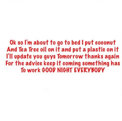 Gorilla Glue Girl — Text update from Tessica Brown about trying coconut oil and tea tree oil to remove Gorilla Glue