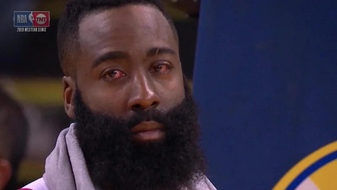 James Harden's Red Eyes — Close-up of James Harden with bloodshot red eyes during a 2019 NBA Western Semis broadcast on TNT.
