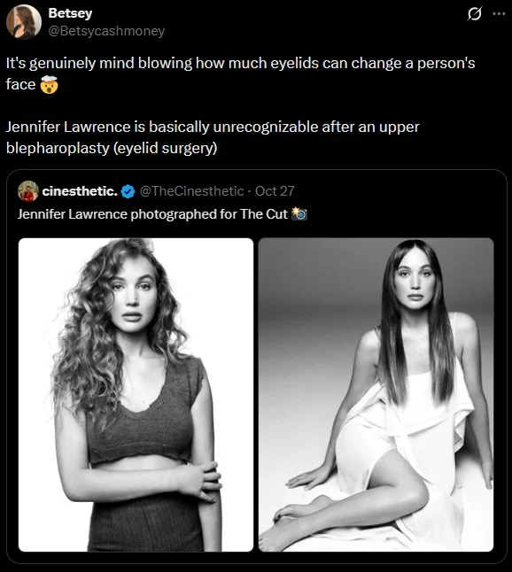 Jennifer Lawrence Plastic Surgery — Tweet discussing Jennifer Lawrence's eyelid surgery with photos from The Cut