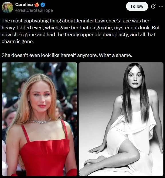 Jennifer Lawrence Plastic Surgery — Tweet by Carolina discussing Jennifer Lawrence's blepharoplasty with before and after images