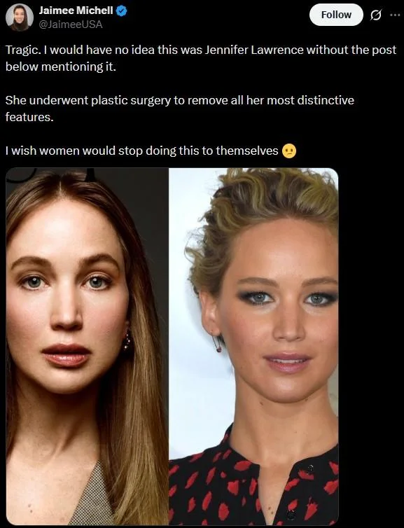Jennifer Lawrence Plastic Surgery — Tweet by Jaimee Michell criticizing Jennifer Lawrence's plastic surgery with before and after photos