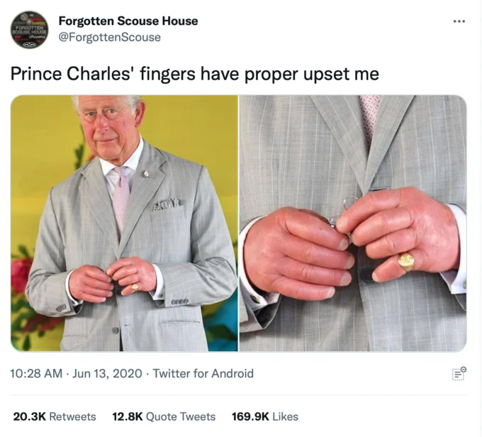 King Charles' Sausage Fingers — Tweet by Forgotten Scouse House showing Prince Charles in grey suit next to close-up of his swollen fingers
