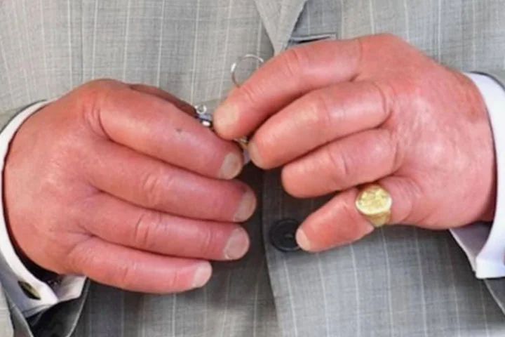 King Charles' Sausage Fingers
