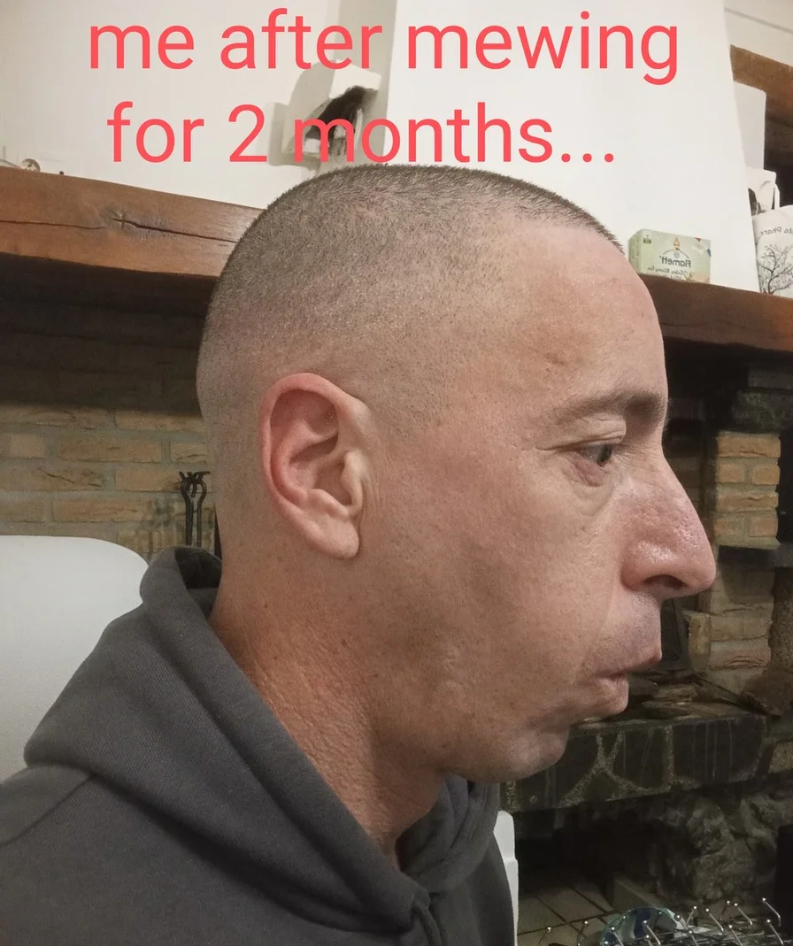 Side-profile photograph with red text overlay 'me after mewing for 2 months...' emphasizing claimed jaw definition improvements.