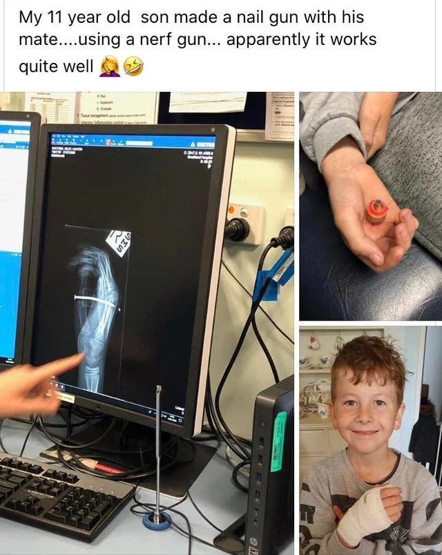 Social post about a child making a nail gun from a Nerf blaster with X-ray and bandaged hand photos