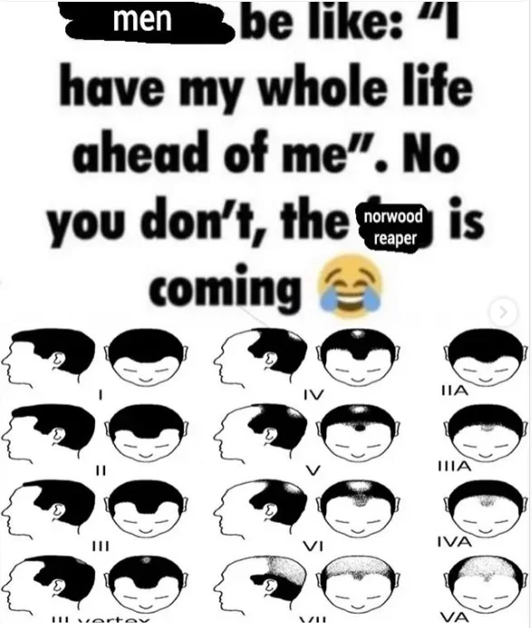 Norwood Scale Norwood Reaper — Meme text 'men be like: I have my whole life ahead of me. No you don't, the norwood is coming' with chart.