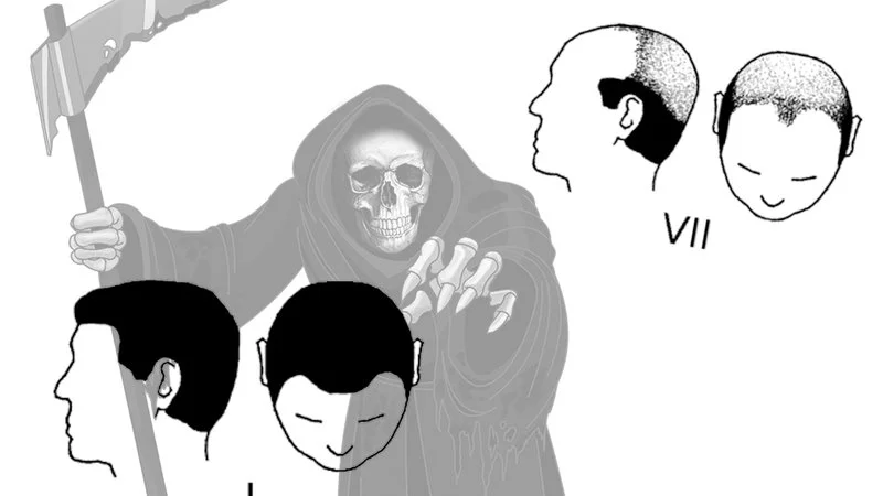 Norwood Scale Norwood Reaper — Grim reaper with skull and scythe above male head silhouettes showing progressive Norwood Scale baldness stages.