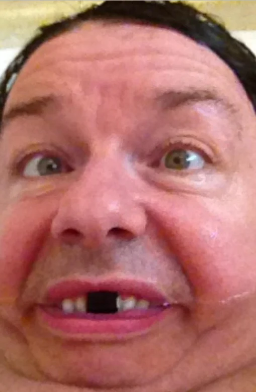 Extreme close-up of Ricky Gervais grinning with a digitally blacked-out front tooth.