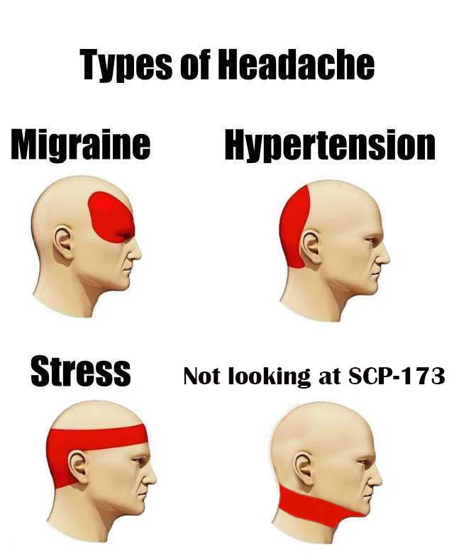 SCP Foundation Memes — A 'Types of Headache' meme using anatomical head diagrams labeled Migraine, Hypertension, Stress, and 'Not looking at SCP-173'