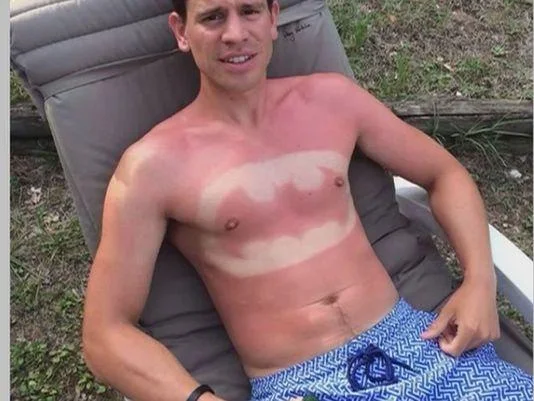 #SunburnArt — Batman logo sunburn art on a man's chest and stomach.