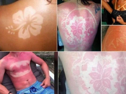 #SunburnArt — Collage of sunburn art examples featuring floral, Batman, and decorative designs on tanned skin.