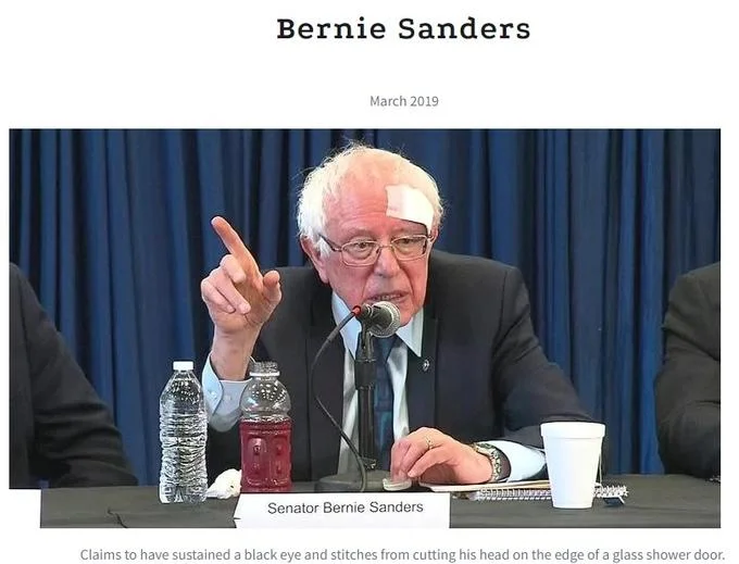 The Black Eye Club — Bernie Sanders with a bandage and black eye at a press event, March 2019