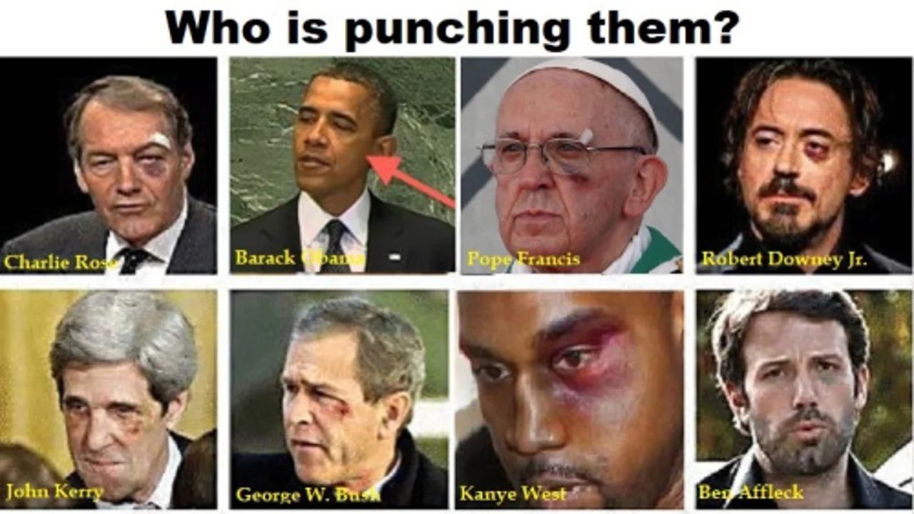 The Black Eye Club — Collage of eight celebrities with black eyes labeled 'Who is punching them?'