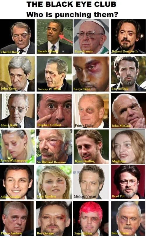 The Black Eye Club — Expanded collage of 24 celebrities and politicians with black eyes