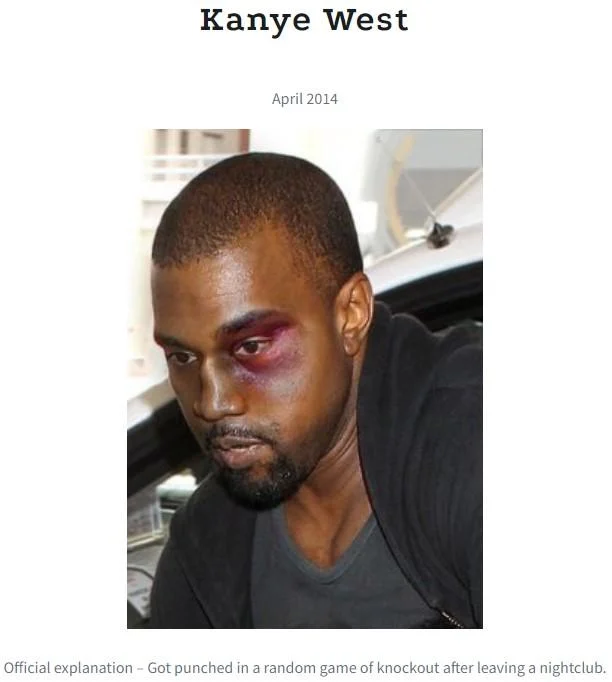 The Black Eye Club — Kanye West with a bruised black eye, April 2014