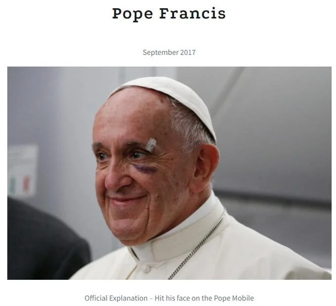 The Black Eye Club — Pope Francis with black eye bruise and forehead bandage, September 2017