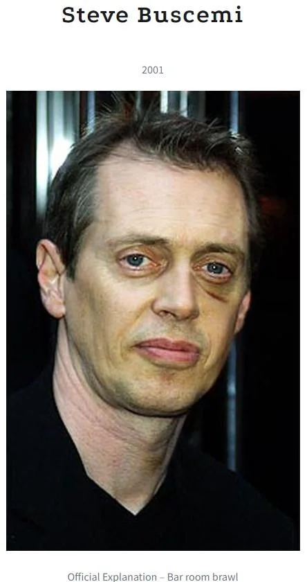 The Black Eye Club — Steve Buscemi with a black eye, 2001