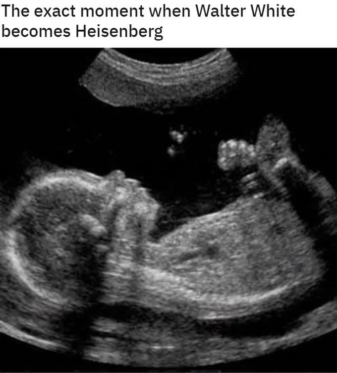 The Exact Moment Walter White Became Heisenberg — Ultrasound of a fetus captioned as the moment Walter White became Heisenberg