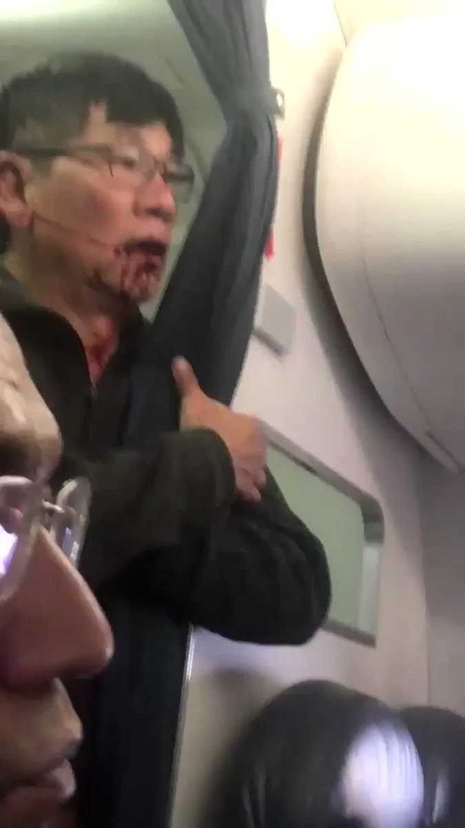 United Airlines Passenger Removal