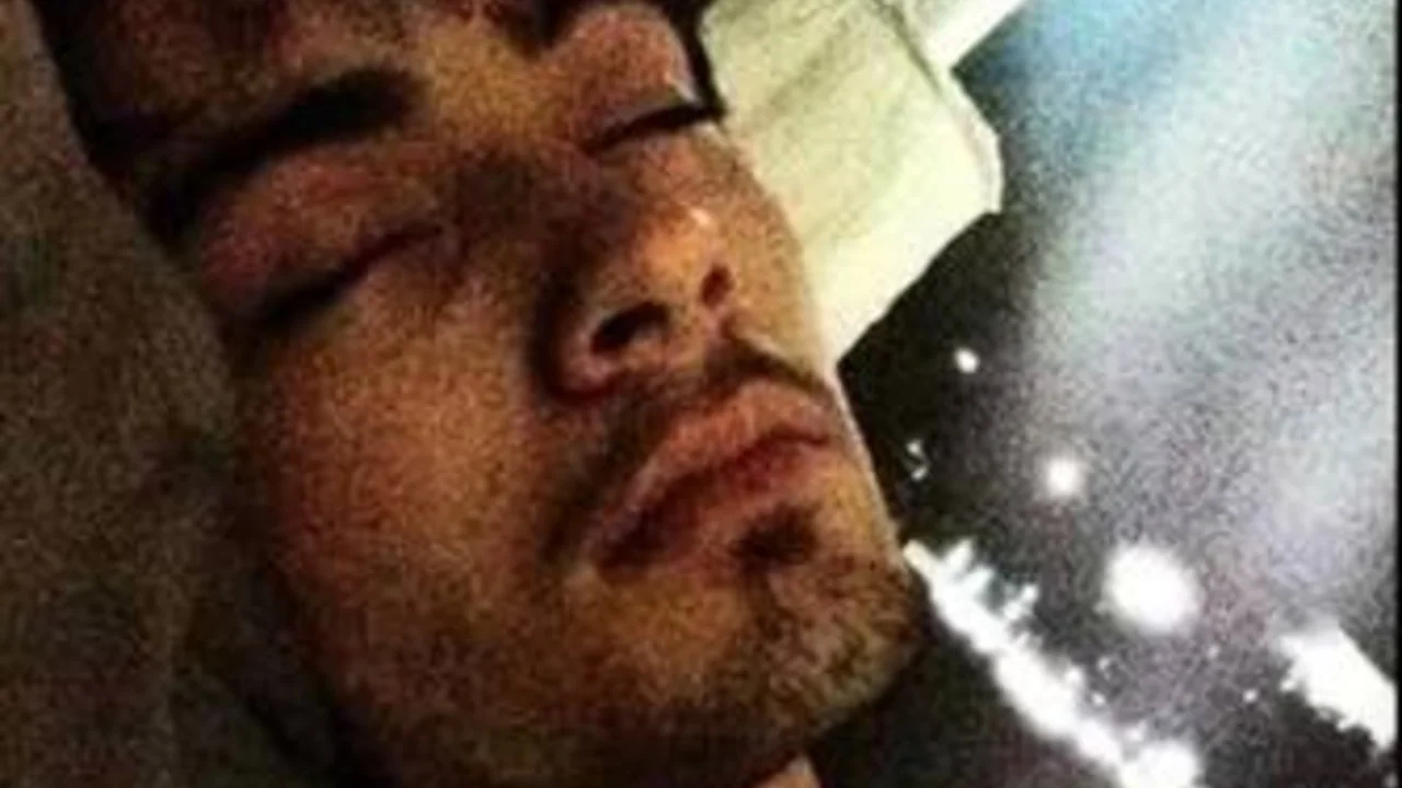 Close-up of Zayn Malik sleeping with eyes closed and city lights behind him